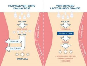 Lactose intolerantie