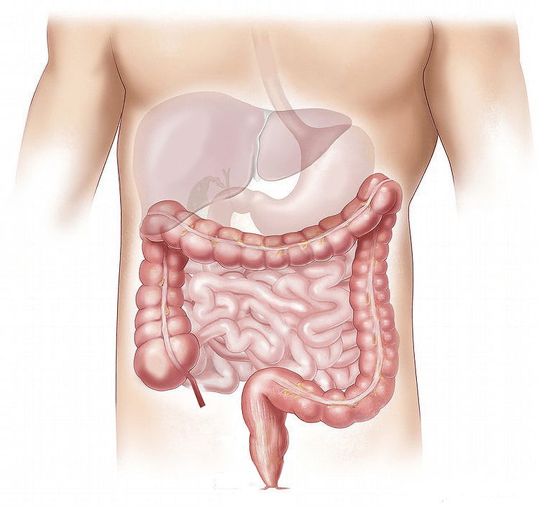 Prikkelbare Darm Syndroom (PDS)